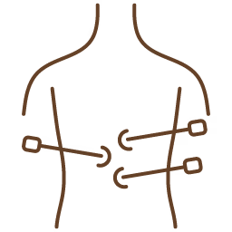 Laparoscopic surgery